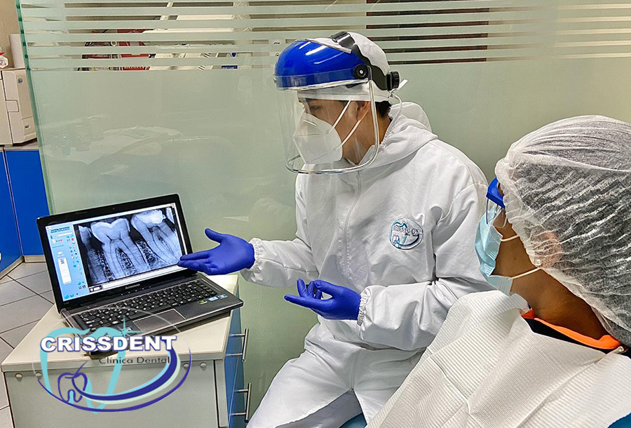 Implantes Dentales