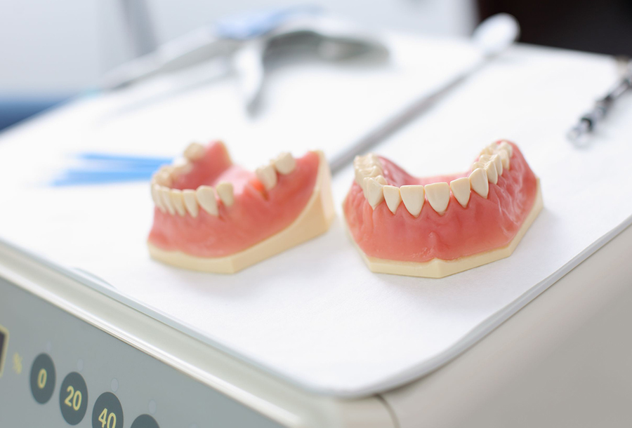 Implantes Dentales