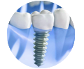 clinica-dental-crissdent