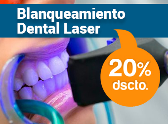 blanqueamiento-dental-laser