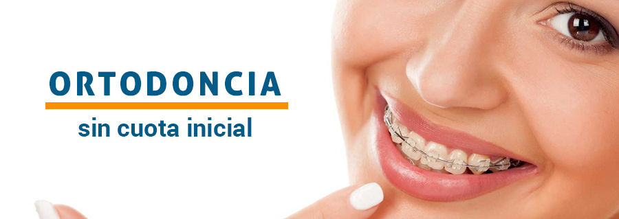 ortodoncia-sin-cuota-inicial
